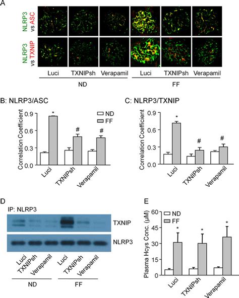 vivo inhibition  txnip   effect  nlrp inflammasome  scientific diagram