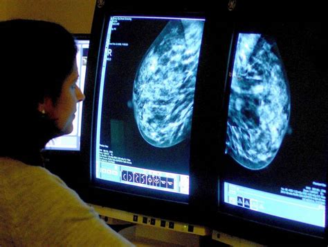the angelina jolie effect more women getting tested for breast cancer