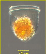 Afbeeldingsresultaten voor "ascampbelliella Urceolata". Grootte: 159 x 185. Bron: www.marinespecies.org