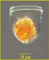 Afbeeldingsresultaten voor "ascampbelliella Obscura". Grootte: 169 x 206. Bron: www.marinespecies.org