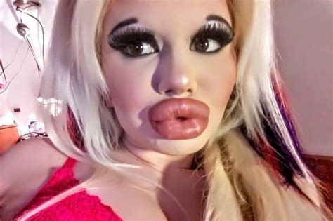 Barbie Doll Wannabe Has 15 Procedures In Just One Year To Look Like Her