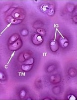 Image result for chondrocyt. Size: 155 x 169. Source: quizlet.com