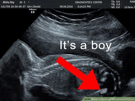 how early can you see gender on ultrasound alqurumresort