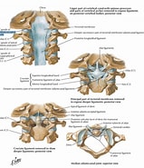 Afbeeldingsresultaten voor Atlanta inclinata Anatomie. Grootte: 159 x 185. Bron: human-anatomylessons.blogspot.com