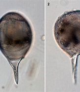 Afbeeldingsresultaten voor "Protocystis Harstoni". Grootte: 162 x 185. Bron: www.biol.tsukuba.ac.jp