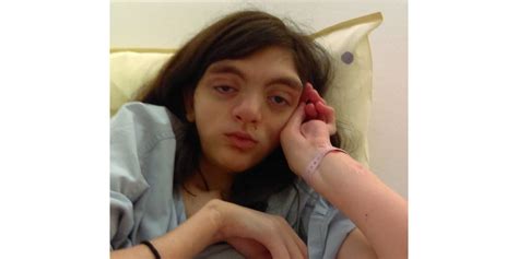 grenoble cette adolescente de 15 ans présentant une infirmité