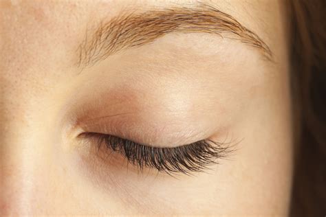 Eyelid Surgery Recovery Little Rock Ar