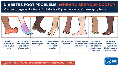 Diabetes Foot Problems When To See Your Doctor Diabetes Cdc