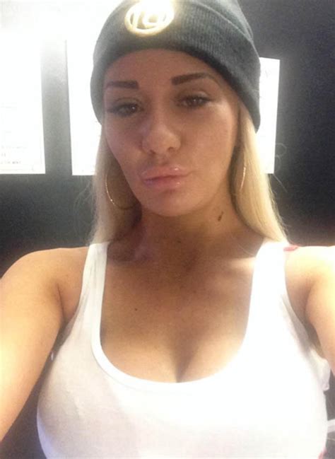 josie cunningham claims she is accepting a free nose job on nhs daily