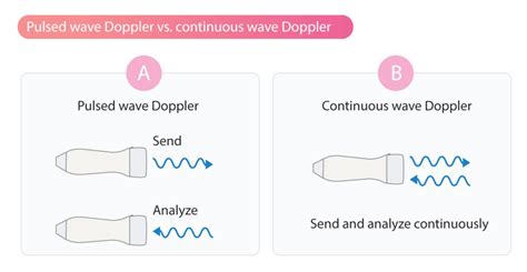 continuous wave doppler cw doppler ecg echo