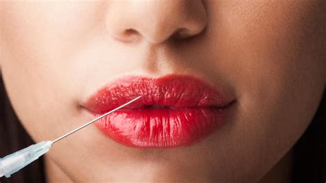 lip injections   popular   city allure