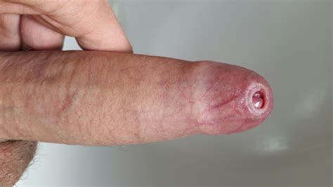 showing media and posts for tight foreskin fuck xxx veu xxx