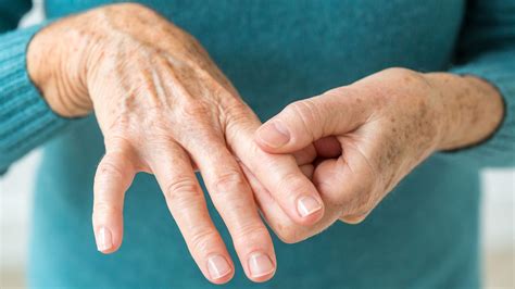 Tips For Living With Rheumatoid Arthritis Everyday Health