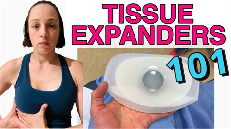 tissue expanders breast reconstruction