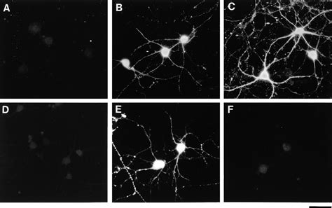 retinal ganglion cells lose trophic responsiveness  axotomy neuron