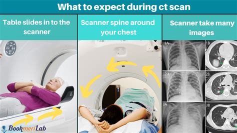 ct scan chest purpose results covid  cost  bookmerilab