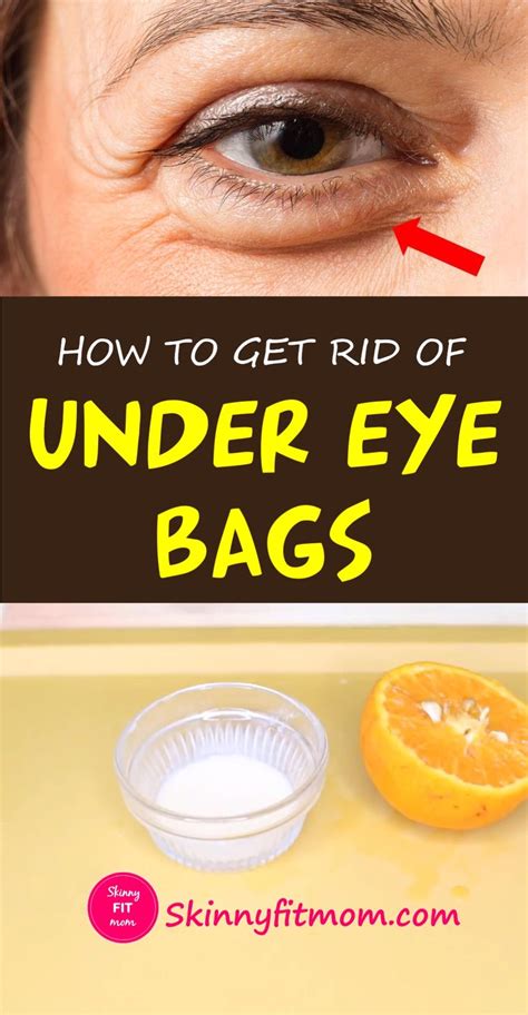 Dark Bags Under Eyes Remedies Dakine Sydney Bag