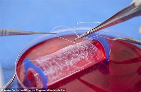 woman born without a vagina is given one grown in laboratory daily