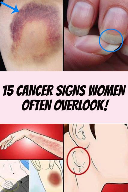 15 Cancer Signs Women Often Overlook