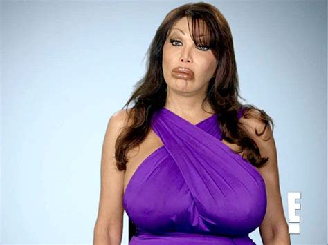 watch the trailer for season 2 of botched