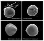 Afbeeldingsresultaten voor "prorocentrum Foraminosum". Grootte: 150 x 138. Bron: www.researchgate.net