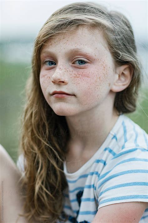 Portrait Of Pensive Young Redhead Girl With Freckles By Raymond Forbes