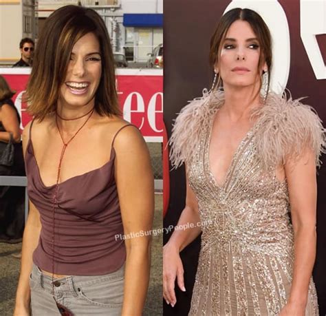 Did Sandra Bullock Have Plastic Surgery Before And After 2021
