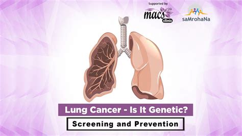 lung cancer genetic  nature macs clinic