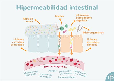 permeabilidad intestinal sintomas  tratamiento nutribiotica