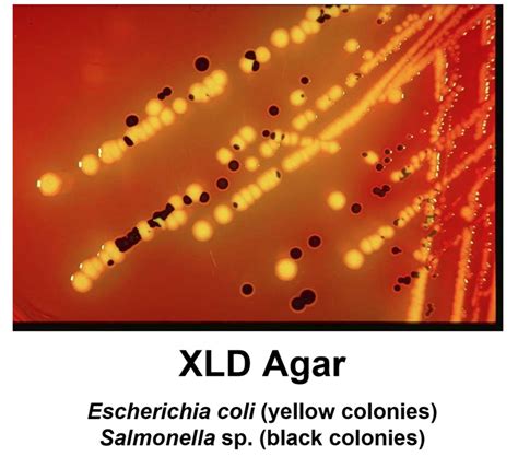 salmonella bioscience diagnostics pte