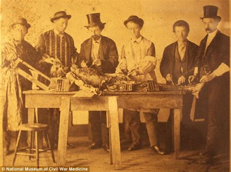 Civil War Surgery The Grisly Photos That Show How Soldiers Gritted