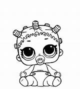 Lol Coloring Dolls Pages Baby Surprise Kids sketch template
