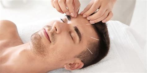 Mengenal Akupunktur Medik Metode Terapi Yang Kini Banyak Diminati