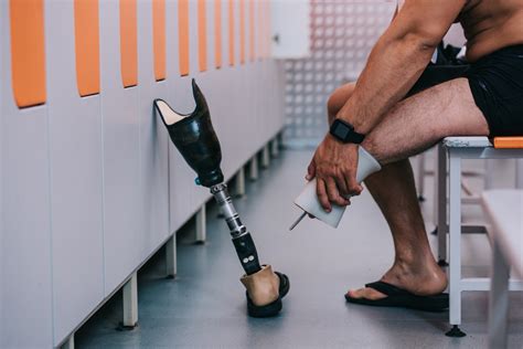 main types  prosthetic limbs stubbs prosthetics orthotics