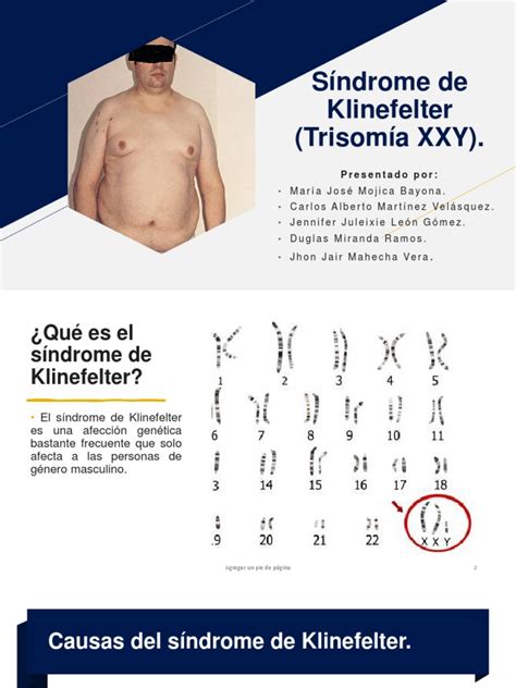 Síndrome De Klinefelter Trisomía Xxy Pdf Especialidades Medicas