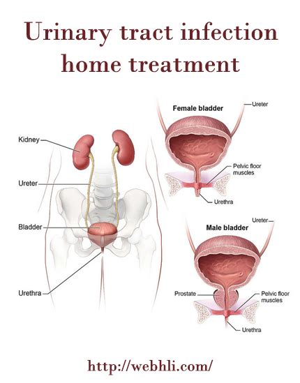 Urinary Tract Infection Home Treatment Healthy Lifestyle