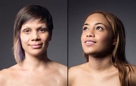 4 women show the reality of their mastectomies in stunning photos