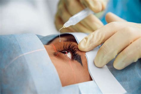 Extracapsular Cataract Surgery Hashmanis Group Of Hospital