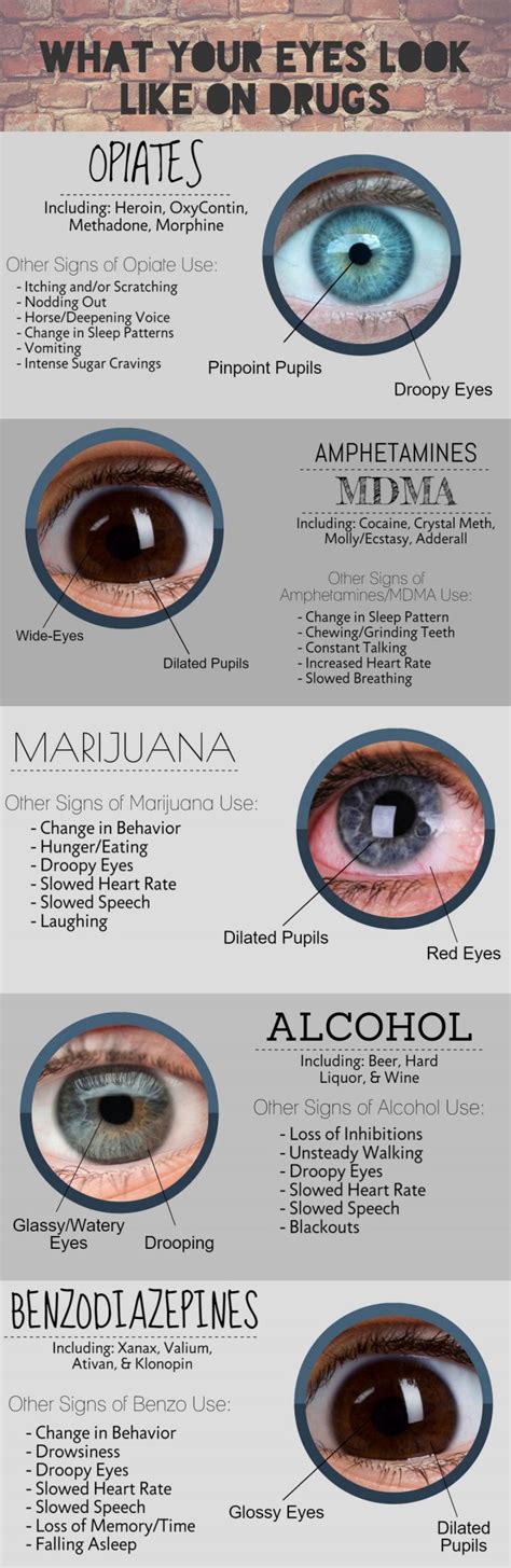 What The Eyes Say About The Drugs Someone Is On