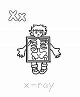 Coloring Ray Drawing Xray Pages Kids Template Getdrawings Easy Popular Clip Library Clipart sketch template