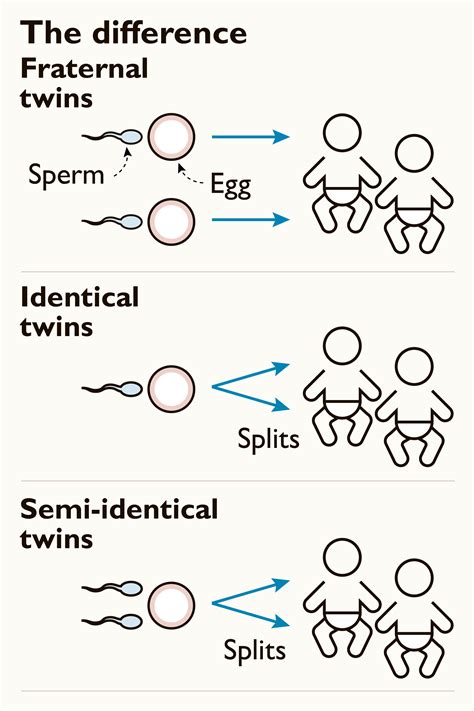 one egg two sperm create rare semi‑identical twins news the times
