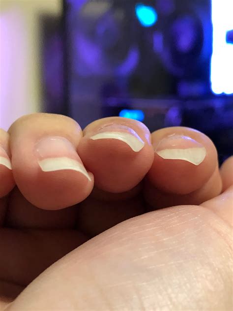 prevent  nails  curling      nails
