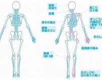 整形外科とは に対する画像結果.サイズ: 203 x 160。ソース: www.kurakawa-cl.com