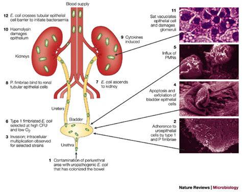 Swarming Motility In Proteus Mirabilis Causative Agent Of Utis