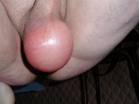 urethra penis insertion torture