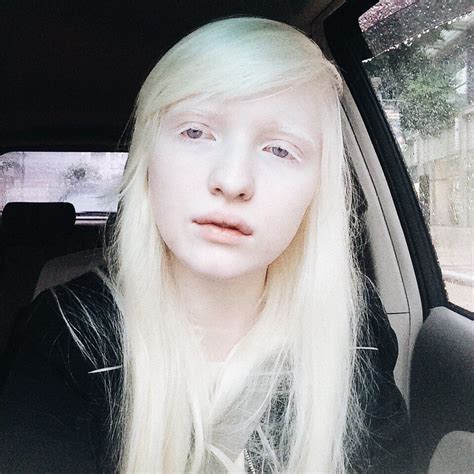 Albinonastya Albino Girl Albino Girl Albino Human