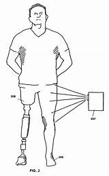 Prosthetic Patents Drawing Patenten Afbeeldingen Limb Google Patent sketch template