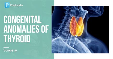 congenital anomalies  thyroid