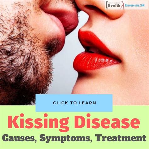 kissing disease  symptoms treatment  mononucleosis