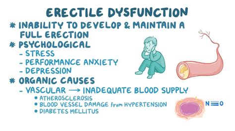 buzz  erectile dysfunction ed orsaker diagnos och behandling